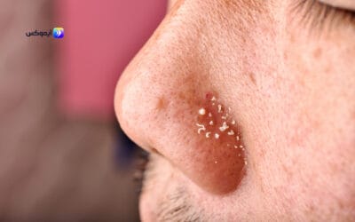 أفضل أنواع السيروم للبشرة الدهنية: اختيارك الأمثل مع تطبيق آيموكس