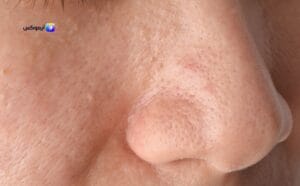 انواع صابون للبشرة الدهنية