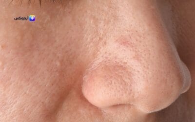 انواع صابون للبشرة الدهنية المتوفرة على تطبيق آيموكس