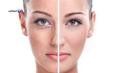 مقشر للبشرة الدهنية وحب الشباب طبيعي عبر تطبيق آيموكس