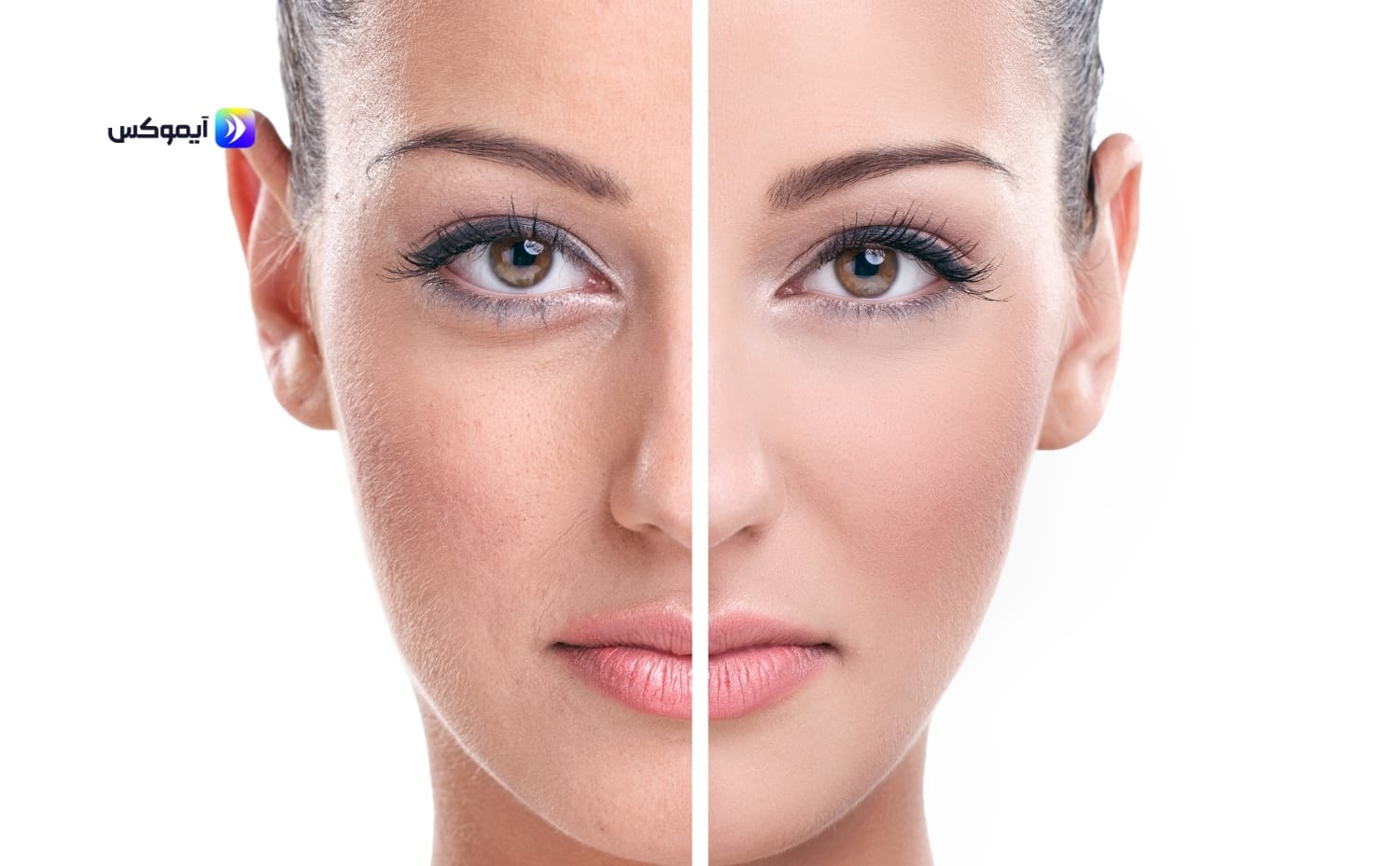 مقشر للبشرة الدهنية وحب الشباب طبيعي