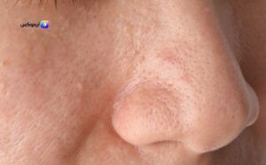 منتجات العناية بالبشرة الدهنية واسعارها