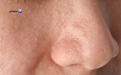 منتجات العناية بالبشرة الدهنية واسعارها من تطبيق آيموكس